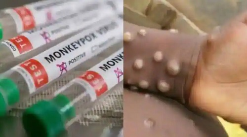 # Alert in Uttarakhand regarding monkeypox
